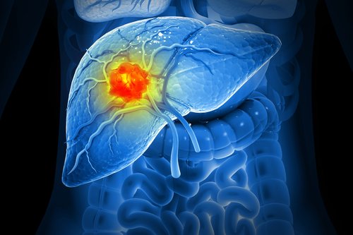Enhance Your Search Sensitivity with AI: Off-Target Effects of BRAF Featured Image