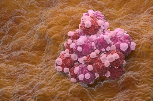 Enhance Your Search Sensitivity with AI: Off-Target Effects of BRAF Featured Image